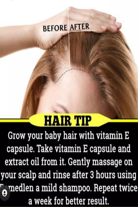 Grow Baby Hair, Baby Hair Growth, Blonde Hair Care, Hair Care Remedies, How To Grow Your Hair Faster, Transitioning Hairstyles, Lip Color Makeup, Hair Remedies For Growth, Natural Haircare