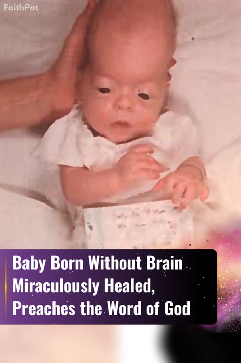 Born without a brain, he defied the odds through faith and prayer. Now, he preaches God's word and shares his powerful story of hope and miracles. #miracle #faith West Monroe Louisiana, Marry That Girl, Miracle Stories, Monroe Louisiana, Christian Stories, Brain Stem, The Way He Looks, Praying To God, The Word Of God