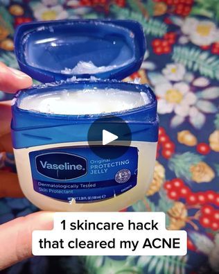 8.6K views · 154 reactions | Top Doctor Reduces Acne & Blackheads At Home | To reduce blackheads, pimples, and clogged pores... Why does a Celebrity Doctor recommend this odd home remedy?  

Let's see if it really works! | By LuxuryConfidence | Facebook A Celebrity, Clogged Pores, Vaseline, Skin Protection, Blackheads, Home Remedies, Natural Skin Care, Skin Care Tips, It Works