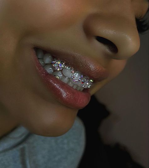 Bedazzled Teeth, Teeth Jewelry Aesthetic, Teeth Jewels, Mommy Makeover Surgery, Teeth Gems, Pretty Teeth, Grillz Teeth, Diamond Teeth, Brace Face