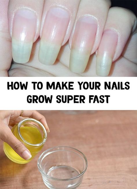 Nails Hardener, Growing Nails, Healthy Fingernails, Make Nails Grow, Grow Long Nails, Nail Growth Tips, Nails Grunge, Grow Nails Faster, Healthy Look