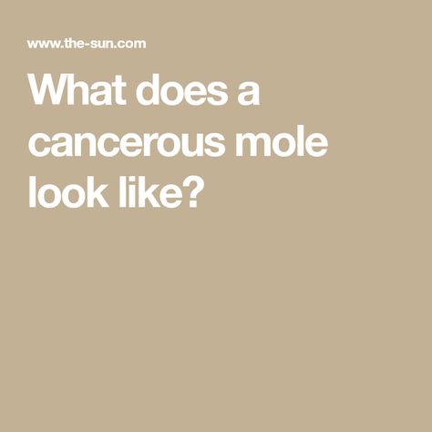 What does a cancerous mole look like? Cancerous Moles, Different Shades Of Black, The Signs, Mole, The Uk, About Uk, Signs, Skin