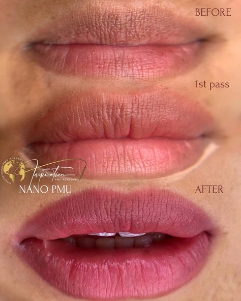 FAQ: “How many sessions will I need for my lip neutralization?” The truth is, I cannot guarantee an exact number of sessions for anyone. Each set of lips is unique and the process depends on many individual factors, including natural lip tone, lip tissue density, body chemistry, your lifestyle, a prep done and post care followed etc. One thing I can guarantee is patience as you will need at least 8-12 weeks between sessions to see the colour appear. If you would like to start your own jo... Lip Neutralization, Body Chemistry, Be Patience, California Girl, Natural Lip, 12 Weeks, Natural Lips, I Can Not, Chemistry