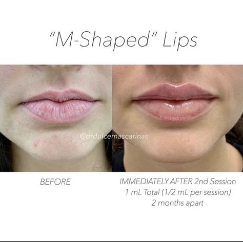 Lower Lip, Bottom Lip, Upper Lip, My Goals, Natural Beauty, The Middle, Lips, To Create, Building