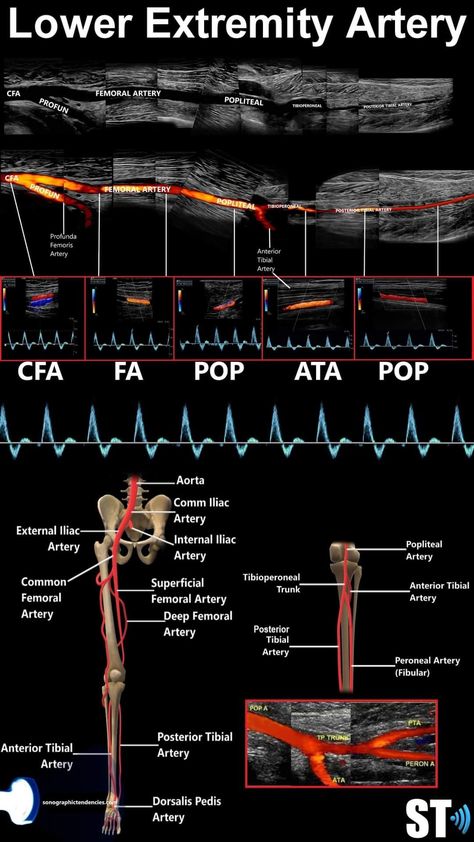 Ultrasound Anatomy, Sonography Student Study, Diagnostic Sonography, Cardiac Ultrasound, Vascular Ultrasound Anatomy, Lower Extremity Venous Ultrasound, Lower Extremity Arterial Ultrasound, Diagnostic Medical Sonography Student, Ultrasound School