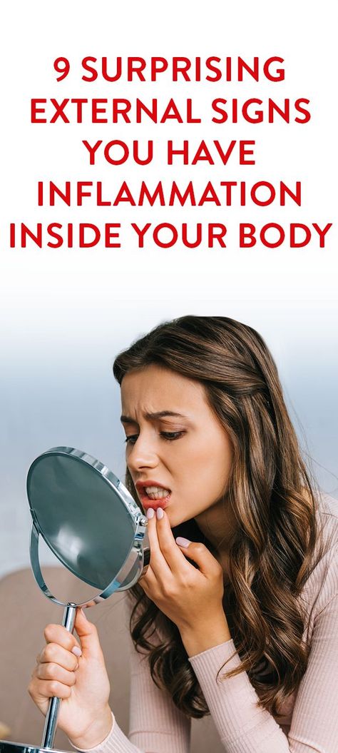 9 Surprising External Signs You Have Inflammation Inside Your Body Skin Inflammation Remedies, Inflammation Remedies, Signs Of Inflammation, Body Inflammation, Body Balance, Meal Recipes, Nerve Pain, Back Pain Relief, Yoga Fashion