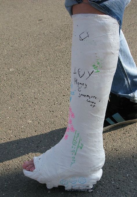 Cast Decoration, Long Leg Cast, Arm Cast, Drawing Legs, Leg Cast, Broken Arm, Plaster Cast, Chalk Drawings, Color Pencil Drawing