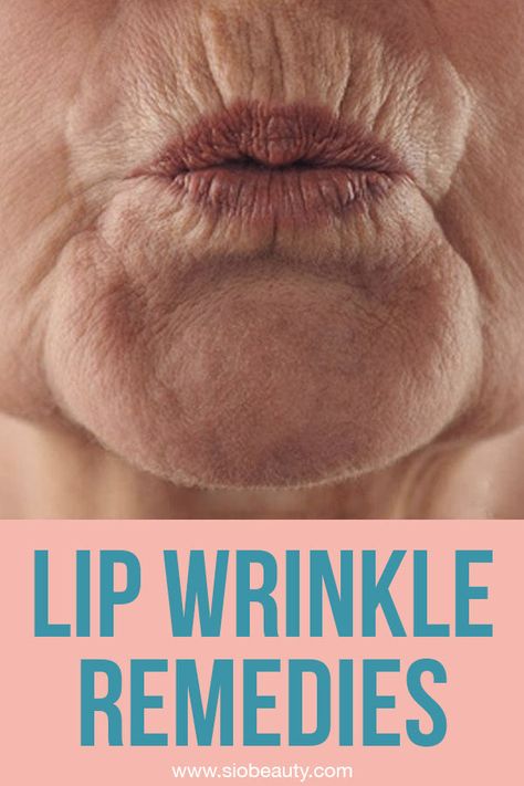 Are you dealing with upper lip wrinkles? You can counteract signs of aging and keep your skin soft and smooth at any age by using the upper lip wrinkle treatments on this list as your guide. Forget about those pesky lines and wrinkles around your mouth! #siobeauty #beautytips #skincare #skincareproducts #lipwrinkles #mouthwrinkles Wrinkles Around Lips, Makeup For Wrinkled Skin, Lip Wrinkles How To Get Rid Of, Wrinkly Lips, Frown Wrinkles, Eye Wrinkles Remedies, Wrinkles Around Mouth, Best Wrinkle Filler, Upper Lip Wrinkles