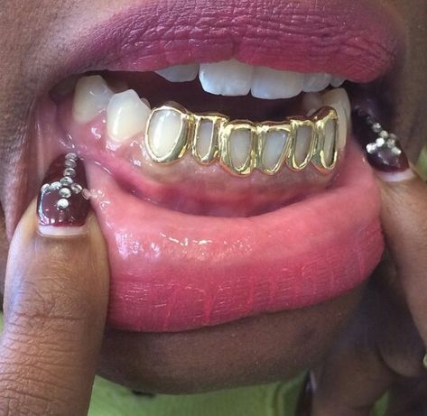 dear my fellow wakandians✊🏾,                                                             follow @moolahgang🌻 Girl Grillz, Grillz Teeth, Teeth Caps, Diamond Grillz, Gold Grill, Hip Hop Bling, Gold Grillz, Grills Teeth, Tooth Gem