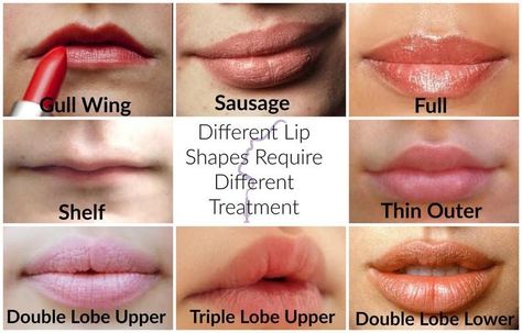 Different types of lips and cosmetic enhancements 2 Lip Shapes Chart Filler, Types Of Lips Shape, Types Of Lips, Triple Lobe, Lip Types, Botox Lips, Shape Chart, Hyaluronic Acid Fillers, Cosmetic Injectables