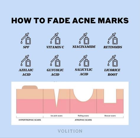 Fade Acne Marks, Hypertrophic Scars, How To Fade, Acne Scar, Acne Spots, Acne Marks, Glass Skin, Health Tips, Acne