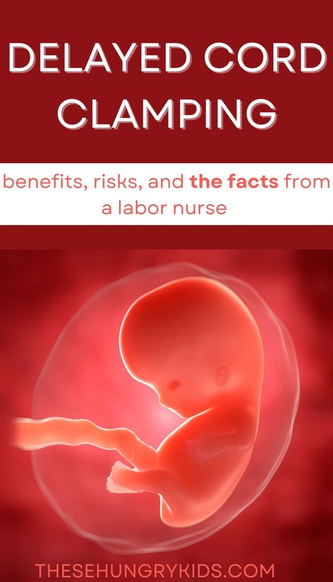 Delayed Cord Clamping, Labor Nurse, Induce Labor, Labor And Delivery Nurse, Delivery Nurse, Labor And Delivery, After Birth, C Section, Registered Nurse