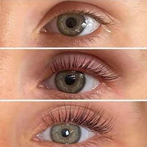 Check out these stunning before and after results with our lash growth serum. Longer, fuller lashes in just weeks! 💥 #LashGoals #BeforeAndAfter #LashSerum #BeautyTransformations Shop Now - https://www.dermaworks.co.uk/products/spectaculash-eyelash-growth-serum Lash Serum Before And After, Hair Growth Patterns, Get Long Eyelashes, False Eyelash Remover, Lash Growth Serum, Lash Growth, Lash Boost, Diy Lash Extensions, Eyelash Growth Serum