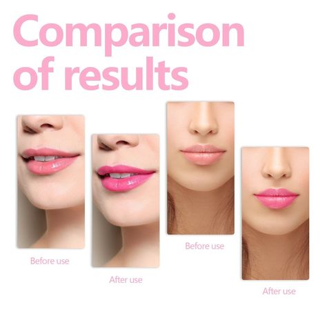 Fade And Smooth Fine Lines Of Lips Nourishing Moisturizing Lip Care Oil Beauty Supplies https://mariaochoarussell.store/products/fade-and-smooth-fine-lines-of-lips-nourishing-moisturizing-lip-care-oil-beauty-supplies BigDrop #Hot Perfect Lip Color, Dry Cracked Lips, Glow Oil, Lip Wrinkles, Lip Cosmetics, Cracked Lips, Perfect Lips, Smooth Lips, How To Line Lips