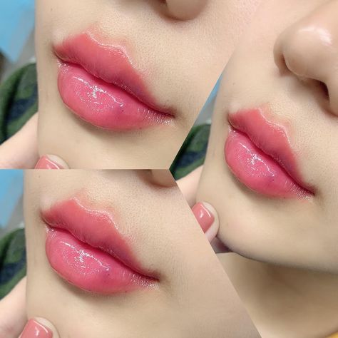 Korean Lip Filler, Cupids Bow Lips, Filler Lip, Lip Surgery, Heart Shaped Lips, Lip Lightening, Lips Inspiration, Botox Lips, Anime Lips