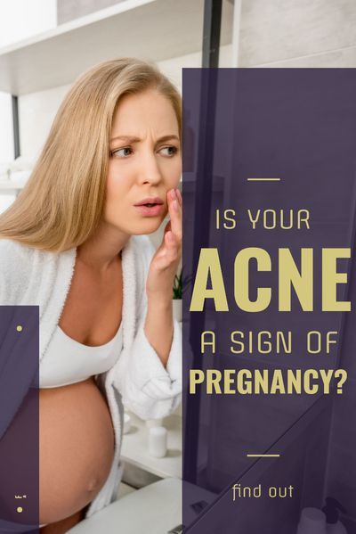 Do you have a weird breakout that seems un-explainable? Acne can actually be one of the first symptoms, even before your missed period.  Here's why and how to know, because not all women will get acne during pregnancy.    #pregnancyacne #acneduringpregnancy #pregnancy #skincare #natural #acne #signofpregnancy Sign Of Pregnancy, Pimple Causes, Pregnancy Acne, Missed Period, Blind Pimple, Pimples Under The Skin, Skincare Habits, Early Pregnancy Signs, Pregnancy Skincare