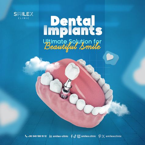 😊Say goodbye to gaps and hello to a beautiful smile with dental implants .  💪the ultimate solution for restoring your confidence!  💪 At SmileX, our experienced team ensures seamless integration and natural-looking results.  📞Reclaim your smile and schedule your implant consultation today!  ⚪ISTANBUL TÜRKÌYE  #orthodontics #straightteeth #veneers⁠ #tooth #dentalimplants #teethwhitening ⁠ #dentist #dental #dentistry #teeth⁠ #İstanbul #türkiye ⁠ Dental Implants Creative Ads, Dental Post, Burger Ads, Dental Ads, Cosmetic Web, Dental Advertising, Dental Social Media, Dental Posts, Teeth Design