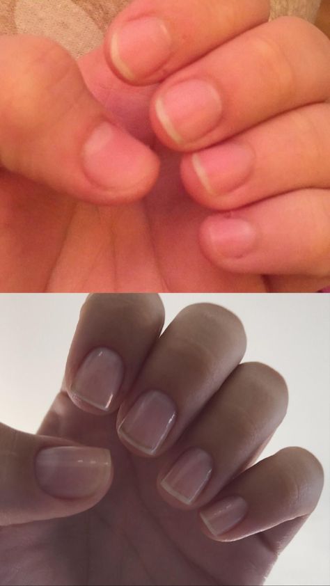 HiiIm new to this sub and i wanted to share my (smallnail growthI was wondering if using a mix of jojoba oilvitamin e oil and tea tree oil could possibly help with growing my nail bedsThanks for inspiring me to take care of my nailsnails nailsart Small Nail Bed Nails, Small Nail Beds, Short Nail Beds, Short Nail Bed, Shifting Items, Nail Beds, Scrolling Through Pinterest, Small Nail, Diy Nails At Home