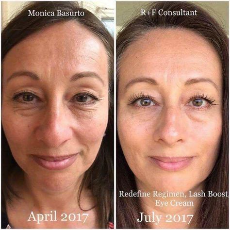 ✨Skin transformation courtesy of Rodan + Fields' Redefine Regimen, beautiful eyes - multifunction eye cream and Lash Boost. What's your holdup? Message me, your results are waiting on you! Click the photo for your FREE skincare recommendation. Anti Wrinkle Skin Care Routine, Multifunction Eye Cream, Redefine Regimen, Skincare Goals, Rodan And Fields Redefine, Aging Backwards, Life Changing Skincare, Skincare Brand, After Photos