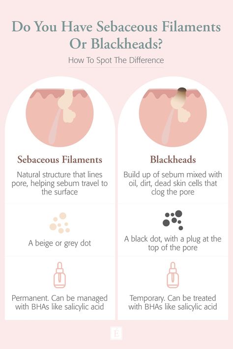 Wondering if you have blackheads? Or are they actually sebaceous filaments? Here's how to spot the difference. #organicskincare #skincaretips #blackheads Sebaceous Filaments, Eminence Organic Skin Care, Rid Of Blackheads, Prevent Pimples, Cold Sores Remedies, Natural Sleep Remedies, Natural Cold Remedies, Get Rid Of Blackheads, Cold Home Remedies