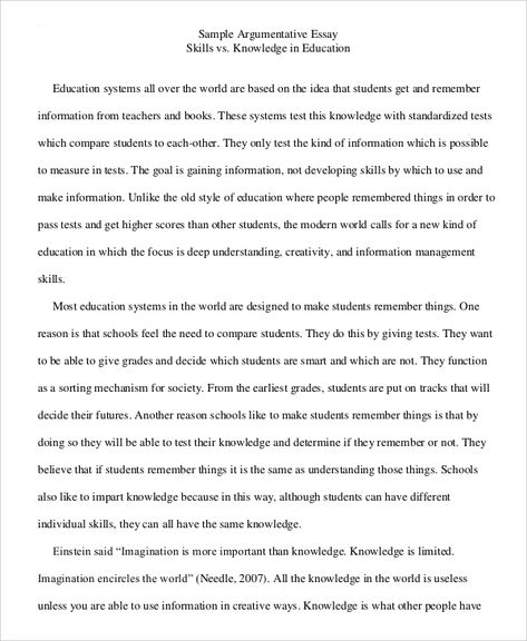 amp-pinterest in action Argumentive Essay, Argumentative Essay Examples, Discursive Essay, Writing Argumentative Essays, Argumentative Essay Outline, Problem Solution Essay, Argument Essay, Essay Writing Examples, Essay Ideas