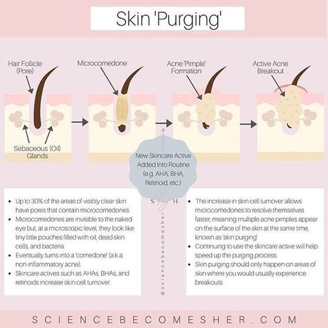 Laura | Skincare Science (@sciencebecomesher) • Instagram photos and videos Scientific Skincare, Skincare Basics, Skincare Content, Skin Facts, Esthetics Room, Skin Advice, Skin Aesthetics, Skin Science, Acne Treatments