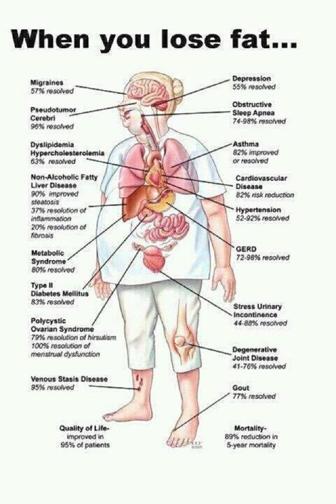 When you lose fat... Makanan Diet, Diet Keto, The Human Body, Health Info, Reduce Weight, Migraine, Get In Shape, Fitness Diet, Healthy Weight