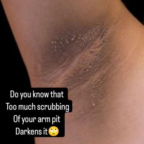 Sounds STRANGE right? Yes but this is the deal👇👇👇 Too much abrasion on any part of your skin will lead to skin darkening reasoning I do kick against using salt/ sugar scrub on the skin I still prefer chemical exfoliation anytime any day. Aside from using anti perspirant, scrubbing your arm pit with that hard sponge darkens your arm pit so STOP. Your water and soap with soft sponge or towel will definitely clean up that area!!! And you won't smell. Your skin renews itself without your aid ... Skin Darkening, Chemical Exfoliation, Anti Perspirant, The Deal, Sugar Scrub, Clean Up, Too Much, Did You Know, Salt