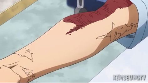 Scar Tattoo, Tv Time, Tv Times, Anime Tattoos, Upside Down, Boku No Hero Academia, Attack On Titan, My Hero Academia, Avatar