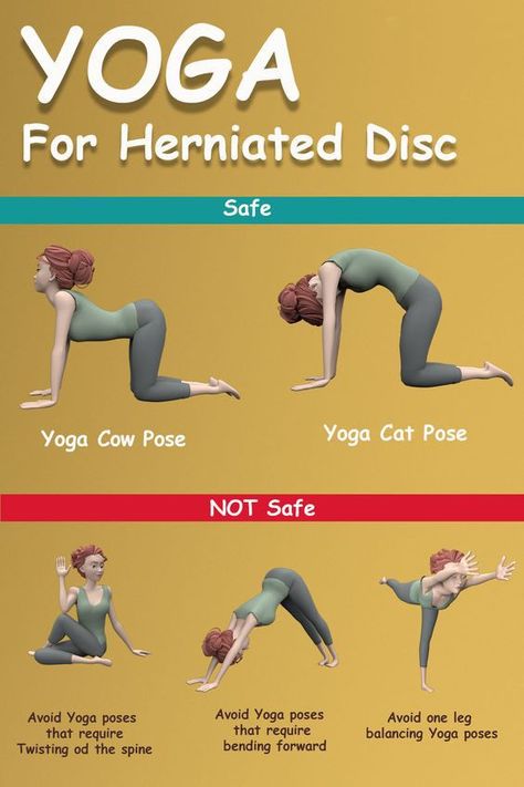 Bulging Disc Exercises, Cat Pose Yoga, Cow Pose Yoga, Cat Cow Yoga Pose, Disc Exercises, Cow Yoga, Pose Tutorial, Lower Back Pain Causes, Cat Cow Pose