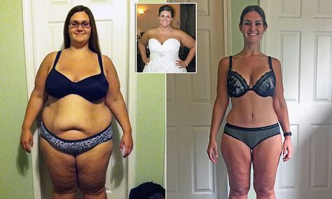 Obese woman drops HALF her body weight thanks to gastric band I Lost 100 Pounds, Garner Style, Gastric Band, Quick Fat Loss, Summer Diet, Kids Meal Plan, Cooking Classes For Kids, Slim Fast, Diet Vegetarian