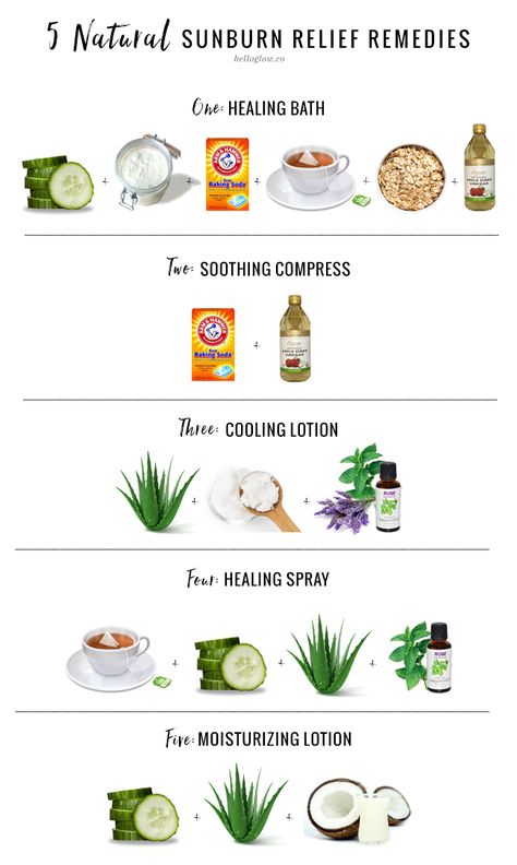 5 remedies for natural sunburn relief that will keep your skin moisturized and help prevent peeling. Natural Wart Remedies, Sunburn Peeling, Natural Remedies For Sunburn, Sunburn Remedies, Sunburn Relief, Cold Sores Remedies, Natural Healing Remedies, Diy Remedies, Natural Cough Remedies