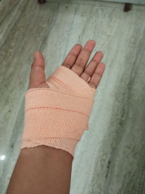 Fracture Hand Plaster Girl, Hand Instagram Story Ideas, Hand Plaster Fracture Snap, Nas Kata Hua Hand Pic Real, Fake Accident Snap Bike, Hand Bandages Fake Story, Hand Damage Dpz Boy, Accident Snap Ideas Hand, Hand Fracture Snap