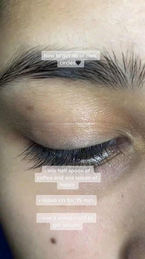 how to get rid of dark circles Dark Circle Remedies, Dark Eye Circles, Natural Face Skin Care, Serious Skin Care, Good Skin Tips, Beauty Routine Tips, Basic Skin Care Routine, Remove Dark Circles, Dark Under Eye