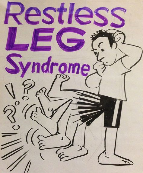 Restless Leg Syndrome. Steve Edwards. Rls Relief, Restless Legs Syndrome Remedies, Restless Leg Remedies, What Helps You Sleep, Calf Cramps, Restless Leg, How Can I Sleep, Multiple Sclerosis Awareness, Restless Legs