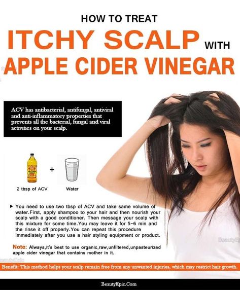 How to Treat Dry Itchy Scalp Using Apple Cider Vinegar (ACV) Apple Cider Vinegar Remedies, Vinegar For Hair, Apple Cider Vinegar For Hair, Hair Conditioning, Dandruff Remedy, Dry Itchy Scalp, Hair Dandruff, Grow Hair Faster, Itchy Scalp