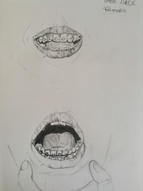 When I first got braces. Draw a man made pattern = braces, summer 2013 brief also Braces Mouth Drawing, Teeth With Braces Drawing, Mouth With Braces Drawing, How To Draw Braces On Teeth, How To Draw A Smile With Teeth, How To Draw Smiles With Teeth, Braces Drawing Reference, How To Draw Braces, Drawing Braces