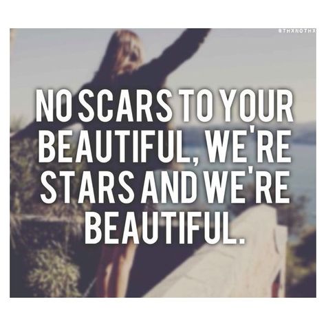 0 Alesia Cara, Allesia Cara, Good Lyrics, Scars To Your Beautiful, Quotes Song Lyrics, Im Good, Meaningful Lyrics, Alessia Cara, Song Lyric Quotes