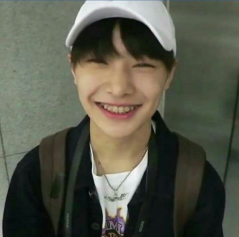 I N Skz Braces, In Braces Skz, Jeongin Braces Icon, In With Braces Skz, I.n With Braces, Men With Braces, Jeongin Braces, Oppa Gangnam Style, Yang Jeongin