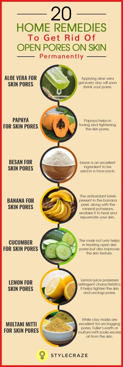 20-Home-Remedies-To-Get-Rid-Of-Open-Pores-On-Skin-Permanently.., Pores On Face, Aloe Vera For Skin, Home Remedies For Skin, Skin Care Routine For 20s, Open Pores, Organic Remedy, Baking Soda Shampoo, Makeup Tricks, Skin Pores