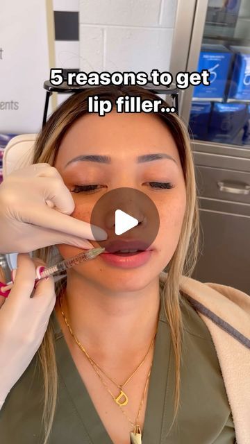 Nicole Smith | California | Botox, Filler, Anti-aging on Instagram: "Just go for it! Lip filler volume & hydration can build self confidence! 💋 . . . 5 reasons to get lip filler… 1. Improve lip hydration  2. Volume 3. Enhance shape 4. Correct lip asymmetries  5. Look younger!  My patient wanted some extra lip plumping and hydration with Juvederm Volbella.   Keep in mind that the final result is at 2 weeks post lip injections. My patient is swollen and her lips will settle nicely!   #lipfiller #lipinjections #lips" 1.5 Ml Lip Filler, Rounded Lip Filler, Lip Filler Lips, Volbella Lips Before And After, Lip Injections Before And After 0.5ml, M Shaped Lips With Filler, Lip Filler 1 Syringe, Lip Botox Before And After, Mini Lip Filler