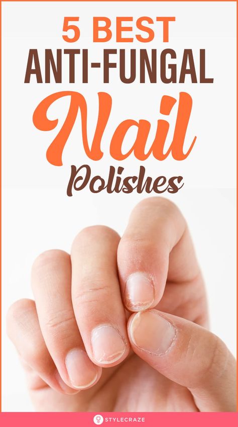 5 Best Anti-Fungal Nail Polish For Fungus Treatments: The best way to hide and treat the infection simultaneously is to use antifungal nail polishes. Fortunately, there are colored and colorless antifungal nail polishes available in the markets that are designed to prevent the growth of fungus under the nails and to make them look better. #Nails #NailCare #NailPolish #AntiFungal Antifungal Nail Polish, Homemade Nail Polish, Toenail Fungal Infection, Nail Remedies, Fingernail Fungus, Nail Fungus Remedy, Nail Infection, Fungal Nail, Ingrown Toe Nail