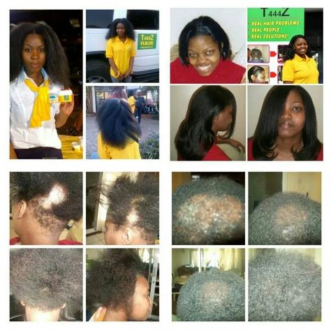 T444z hair revolution get yours today like our facebook page https://m.facebook.com/T444zMiracleHairProduct?ref=bookmark Hair Food, Hair Problems, Facebook Page, Natural Hair, Natural Hair Styles, Hair, Beauty