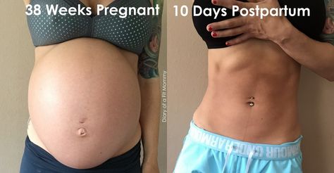 Postpartum Excersise, Post Baby Belly, Diary Of A Fit Mommy, Healing Diastasis Recti, Body After Baby, Post Pregnancy Workout, Fit Pregnancy, Tighten Loose Skin, Baby Workout