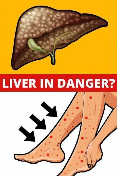 6 signs that your liver is tired and full of toxins Liver Cleanse Juice, Liver Issues, Kidney Detox, Body Muscles, Liver Diet, African Cooking, Liver Failure, Saving Plan, Liver Detoxification