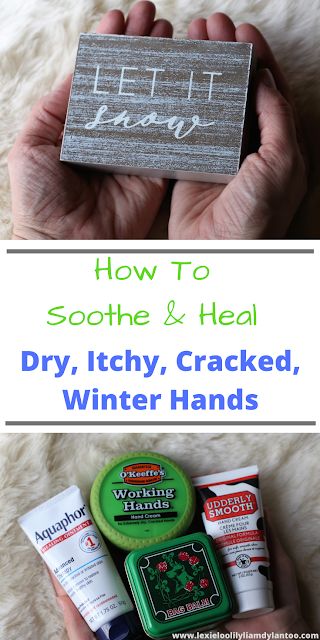 How To Soothe & Heal Dry, Itchy, Cracked, Winter Hands #skincare #dryskin Best Hand Cream For Dry Hands Winter, Cracked Finger Tips, Dry Cracked Hands Remedy, Cracked Hands Remedy, Hand Remedies, Cracked Fingertips, Dry Hands Remedy, Dry Patchy Skin, Extremely Dry Hands