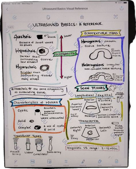 Handwritten Ultrasound Basics Visual Reference. 1 page    Geared towards new DMS Sonography students/anyone just starting to learn about ultrasound. Covers types of echogenicity, echotexture types, characteristics of masses, scan planes, transducer types, and the range for diagnostic ultrasound (a common class test and registry question!). This is a PDF ready to be downloaded to your device.  I don't accept returns, exchanges, or cancellations.  But please contact me if you have any problems wit Cardiovascular Sonography Student, Obgyn Ultrasound Tech, Ultrasound Tech Student, Cardiac Sonography Student, Sonographer Aesthetic, Sonography Notes, Sonography Student Study, Ultrasound Technician Student, Ultrasound Aesthetic