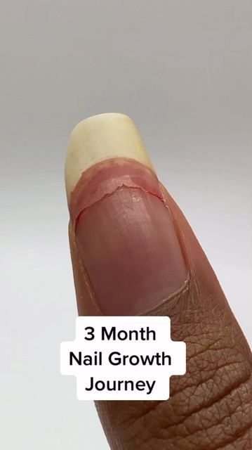 Nail Growth Diy, Nail Soak, Nail Care Tips, How To Grow Nails, Nail Oil, Nail Growth, Trendy Nail Design, Nail Health, Thinning Hair