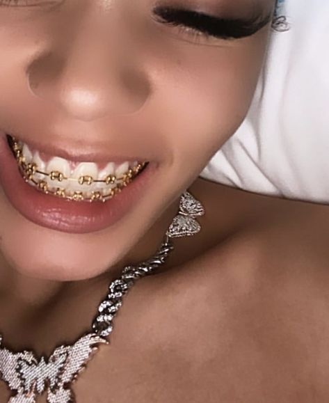 Gold Braces, Coi Leray, Brace Face, Braces Colors, Unique Acrylic Nails, Aesthetic Eyes, Jewelry Fashion Trends, Cool Outfits For Men, Girl Fits