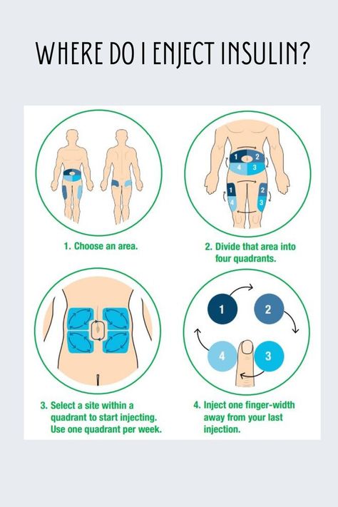 Changing the injection site is one of the key steps to speeding up insulin absorption. Different injection sites have different absorption rates. It is best not to move injection sites daily from one part of the body to another. Instead, go to different places in the area being used. read more: https://www.healthnavigator.org.nz/medicines/i/insulin-injection-sites/ Insulin Injection Sites, Insulin Injection, Injection Sites, Nurse Skills, Insulin Therapy, Types Of Insulin, Lower Blood Sugar, Diet And Nutrition, Blood Sugar